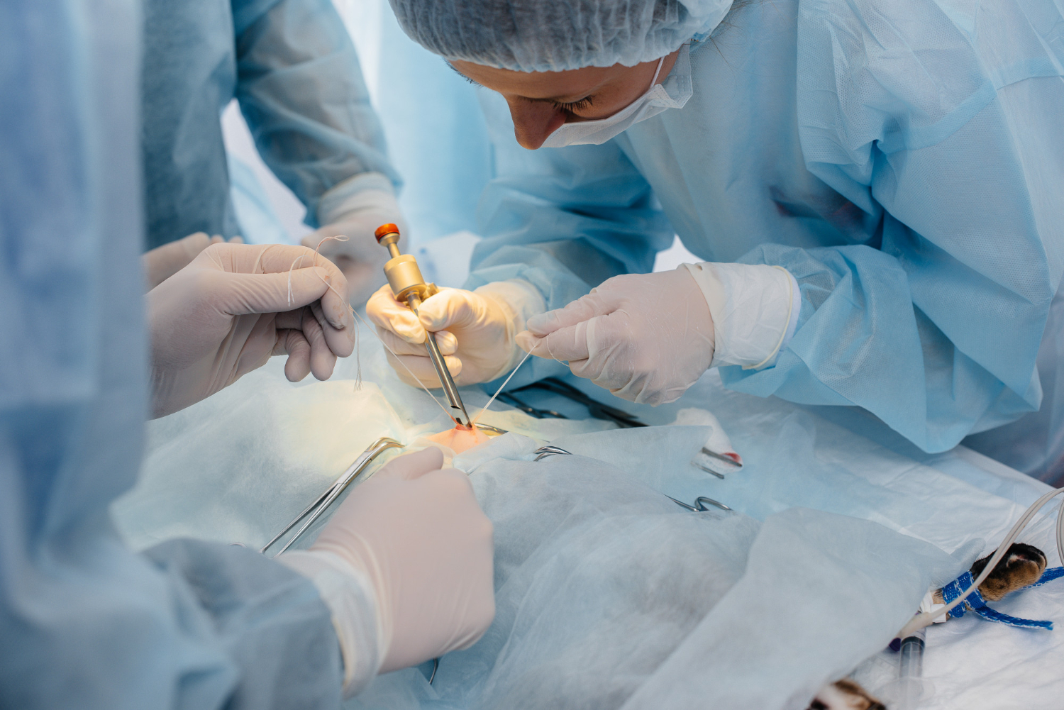Laparoscopic